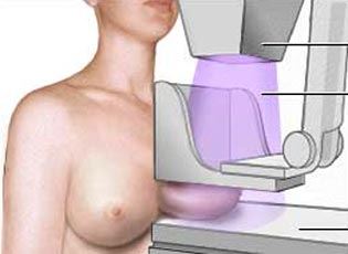 Penamacor: Liga Contra o Cancro convoca mulheres para mamografia